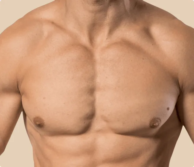 Gynecomastia Surgery - Goals Plastic Surgery®