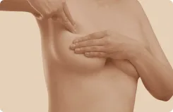 Breast Lift - Goals Plastic Surgery®