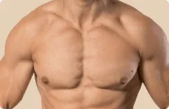 Gynecomastia Surgery - Goals Plastic Surgery®