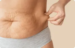 Skin Treatments - Goals Plastic Surgery®