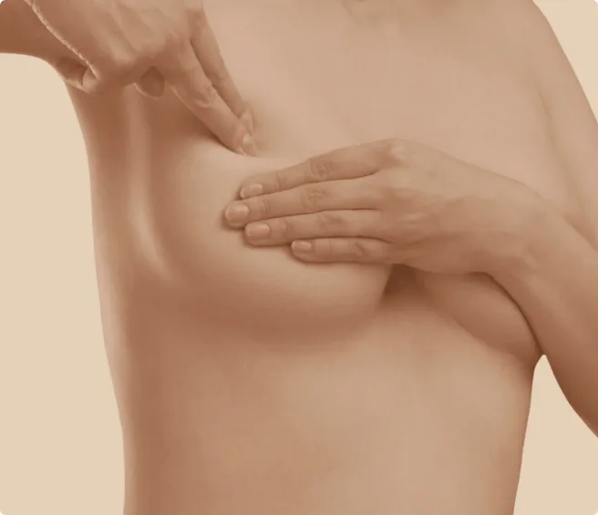 Breast Lift - Goals Plastic Surgery®