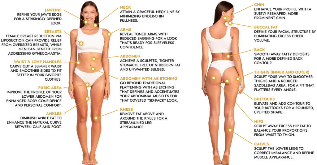FlexSculpt areas - Goals Plastic Surgery®