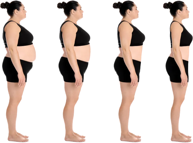 FAT LOSS - Goals Plastic Surgery®